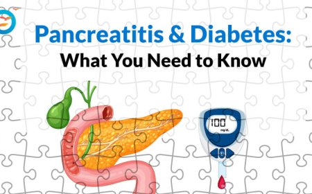 Pancreatitis and Diabetes: Understanding the Link Between the Two
