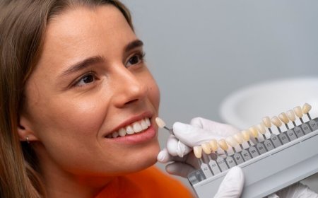 Porcelain Veneers: Key Benefits, Potential Risks, and Long-Term Results