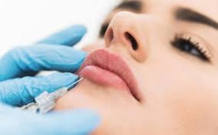 Lip Injections Near Me | GaliDerm Aesthetics in Royal Palm Beach