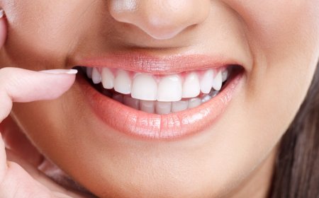 How to Build a Teeth Whitening Routine That Works for You