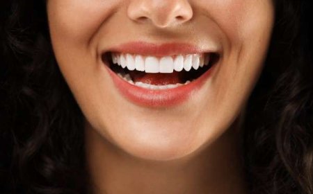 Your Diet Can Influence How Long Teeth Bleaching Results Last