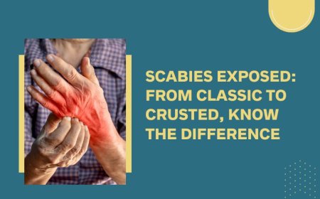 What Is Scabies in Adults and How to Treat It