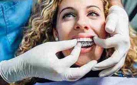 Is It Safe to Chew Gum While Wearing Braces or Invisalign?