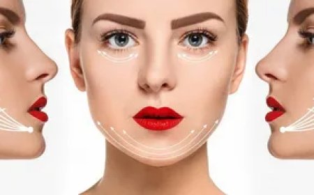 Top Benefits of a Non Surgical Facelift in Islamabad