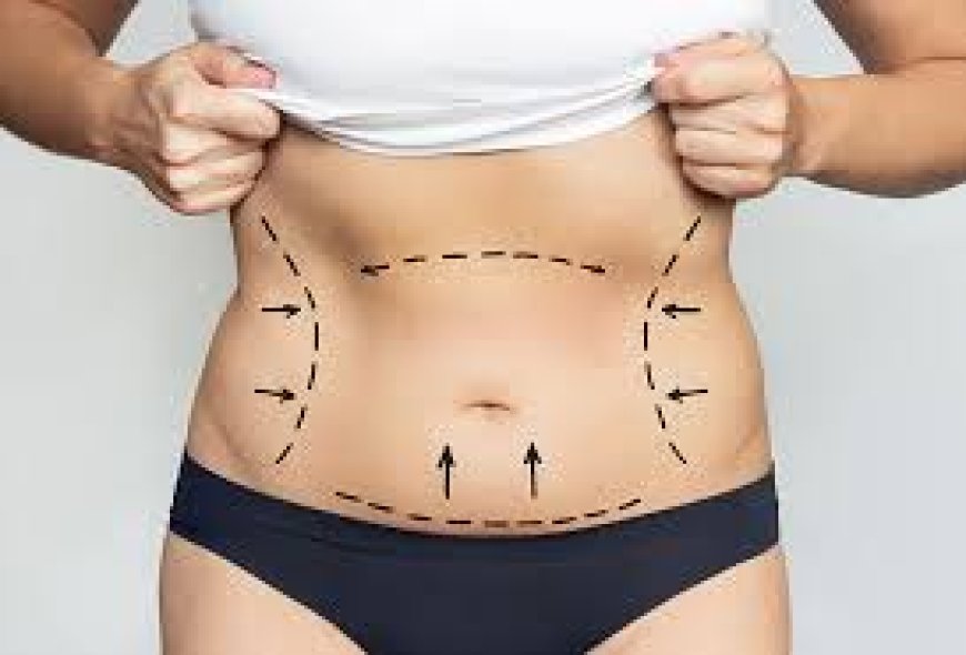 Is Tummy Tuck in Dubai Right for You? Factors to Consider Before Surgery