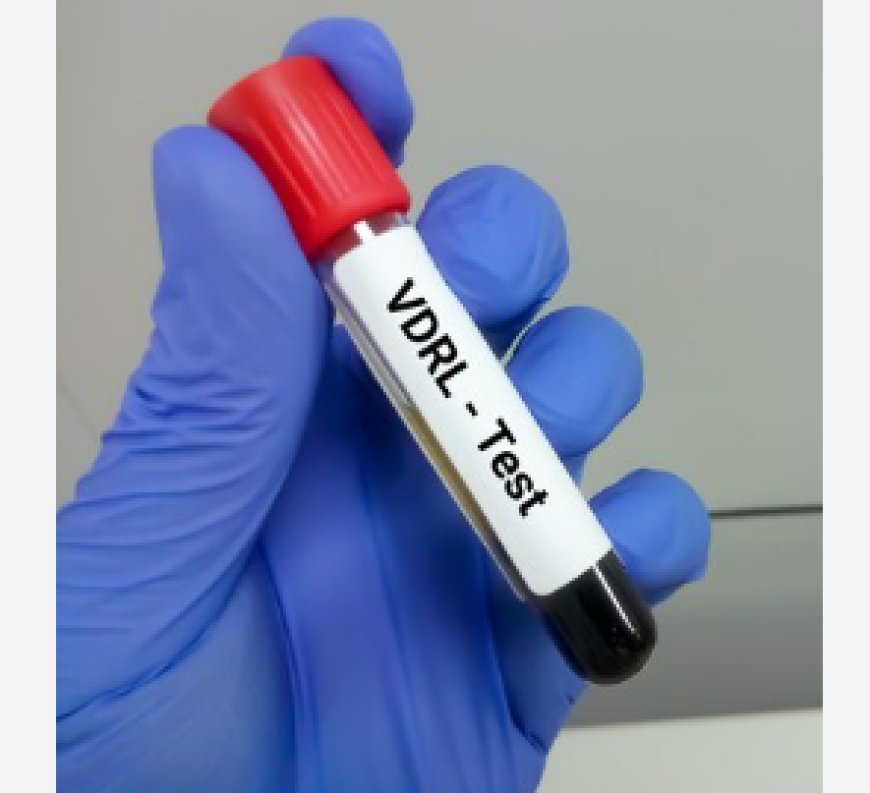 Understanding the VDRL Test and Its Price