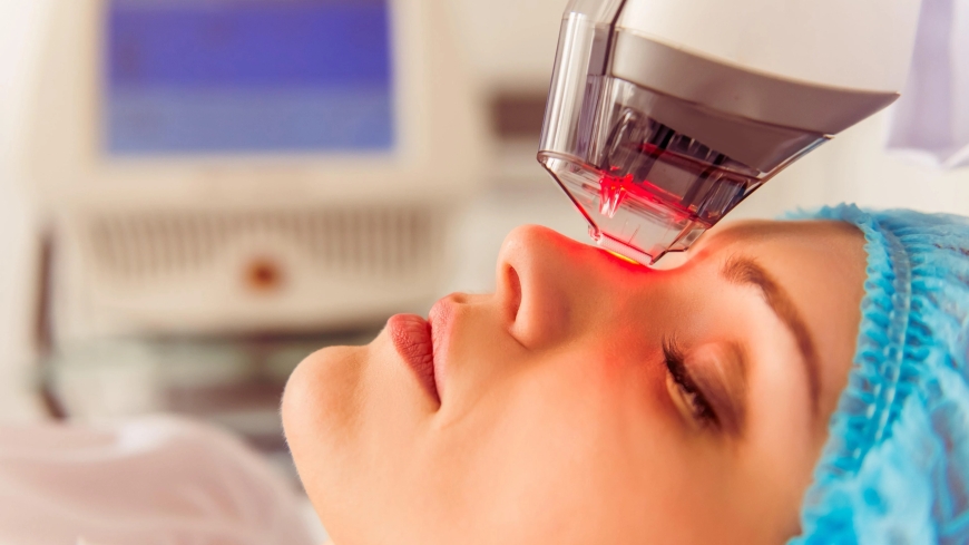 Can Fractional CO2 Laser Help with Melasma?