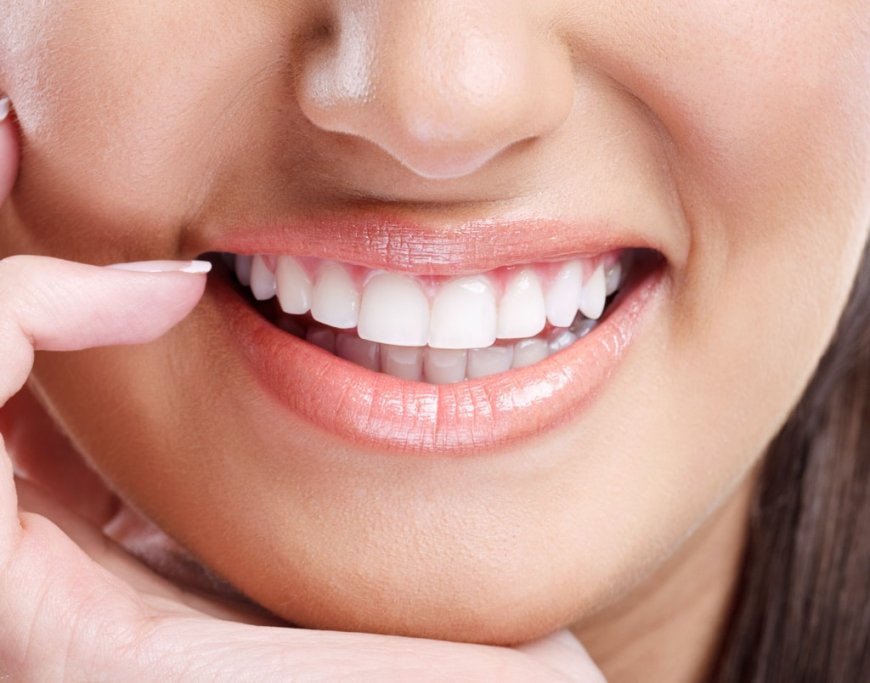 How to Build a Teeth Whitening Routine That Works for You