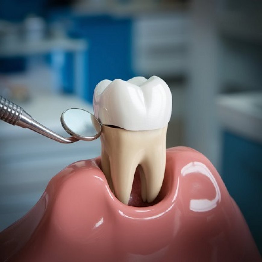 Cracked Teeth? Consider a Dental Crown Solution
