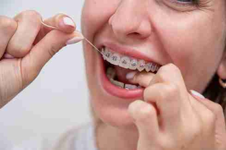 Image Source - Private Dentist Putney