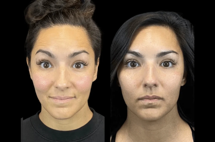 A Day in the Life at the Best Aesthetic Clinic in Dubai – What to Expect